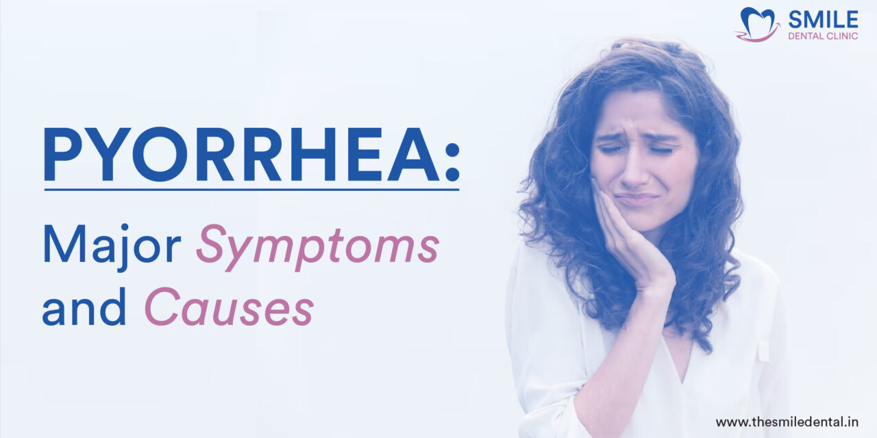 Pyorrhea: Major Symptoms and Causes