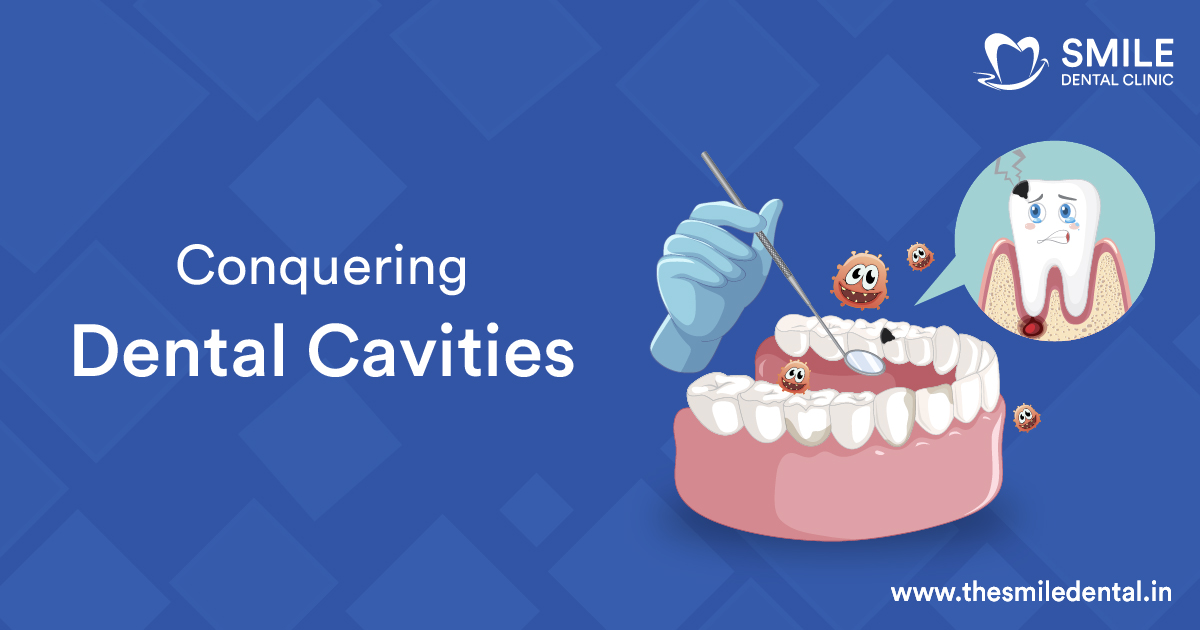 Conquering Dental Cavities with Useful Oral Health Tips