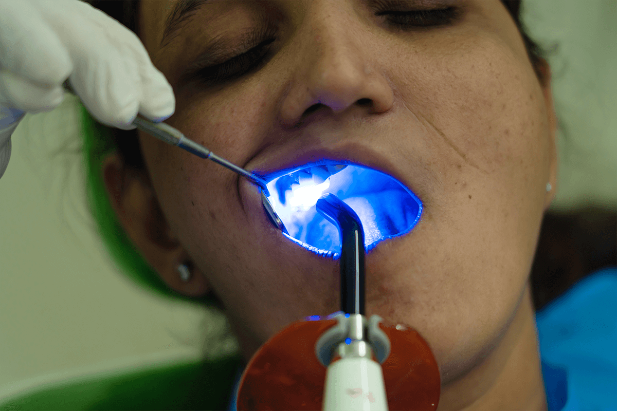 https://thesmiledental.in/wp-content/uploads/2023/07/Gum-Treatment-Surgery-1.png