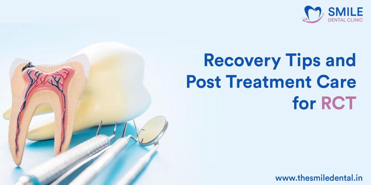 Post Root Canal Treatment Care for Speedy Recovery