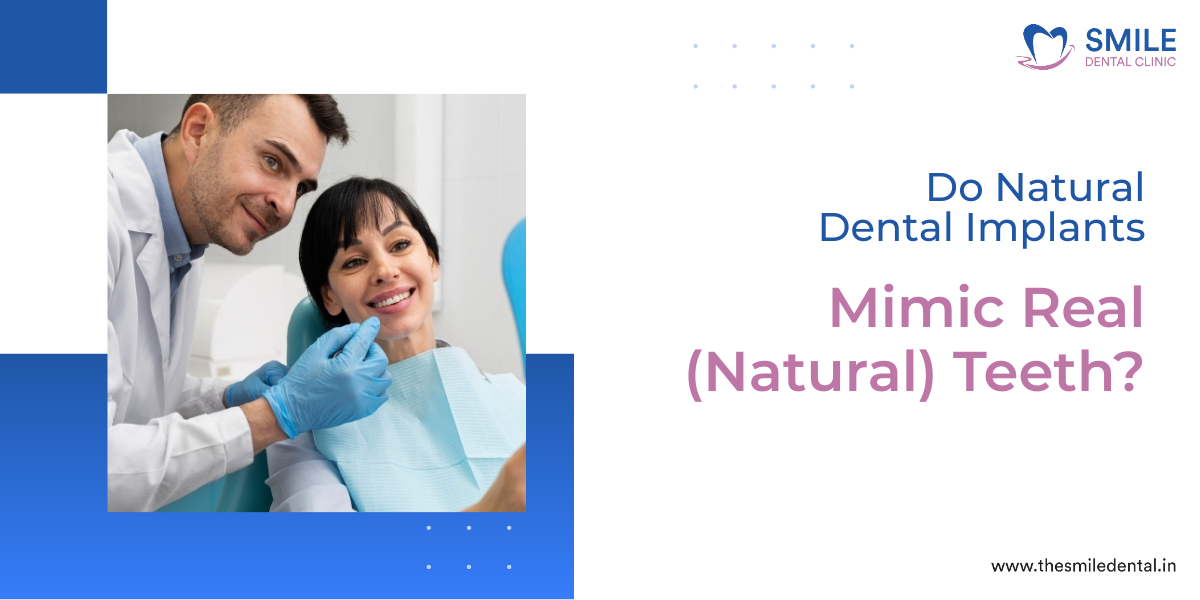 Do Natural Dental Implants Mimic Real (Natural) Teeth?