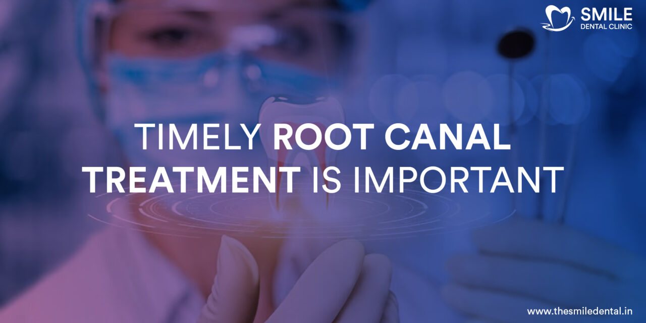 Why Is Timely Root Canal Treatment Important?